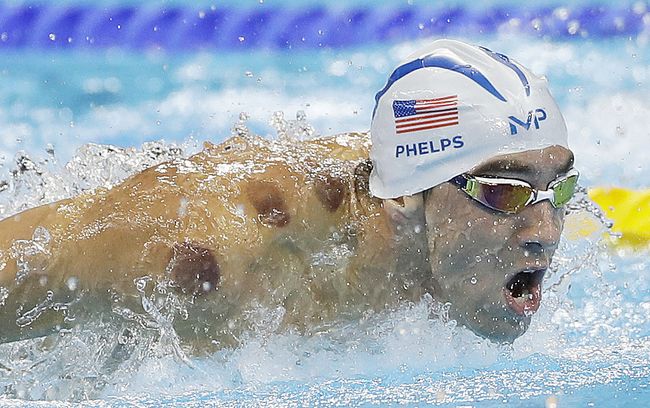 American swimmer Michael Phelps, who holds the record for the most gold medals won at the Summer Games, competing in men’s 200m butterfly after he underwent cupping on the previous days. The marks are visible on his shoulder. [AP]